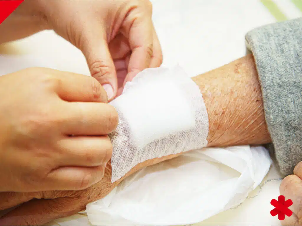 Aplicación de apósito durante una curación de herida